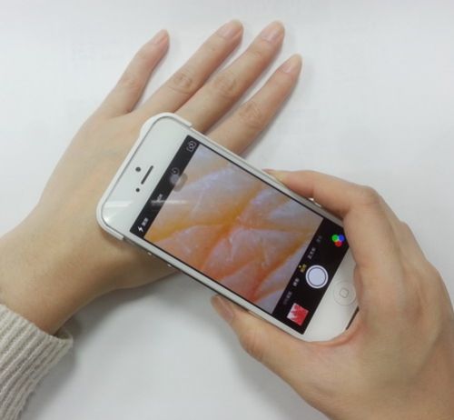 iphone 手機顯微鏡 : 皮膚觀察應用